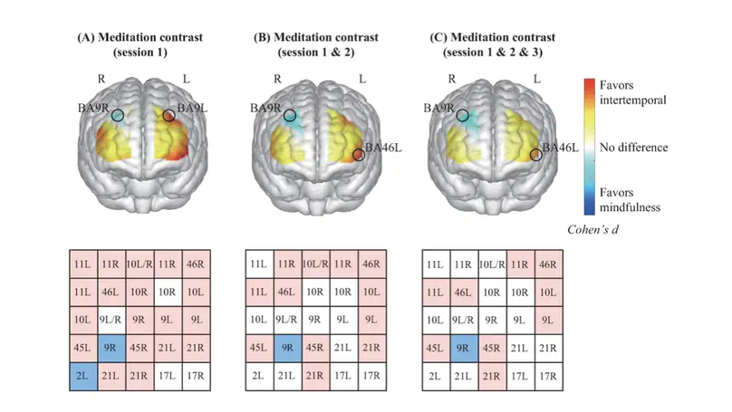 Intertemporal Meditation Regulates Time Perception and Emotions An Exploratory fNIRS Study